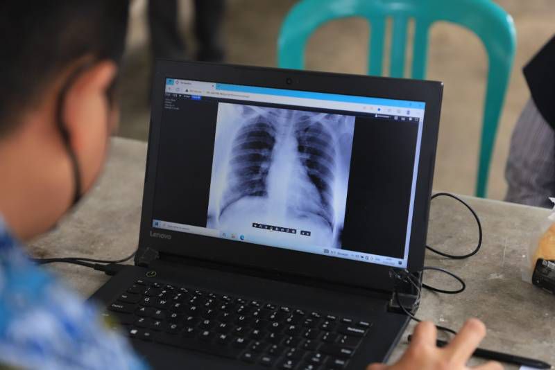 IMG-deteksi-dini-tuberkulosis-dinkes-kota-tangerang-gencarkan-skrining-dengan-portabel-x-ray