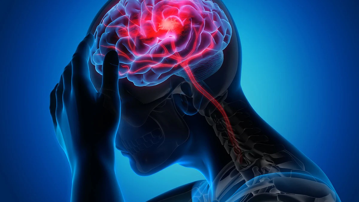 IMG-hari-stroke-sedunia-dinkes-kota-tangerang-imbau-masyarakat-kenali-gejalanya
